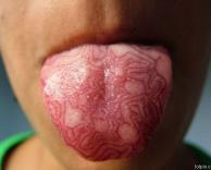 קעקוע בלשון