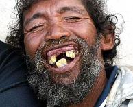 יש לי משהו בשיניים?